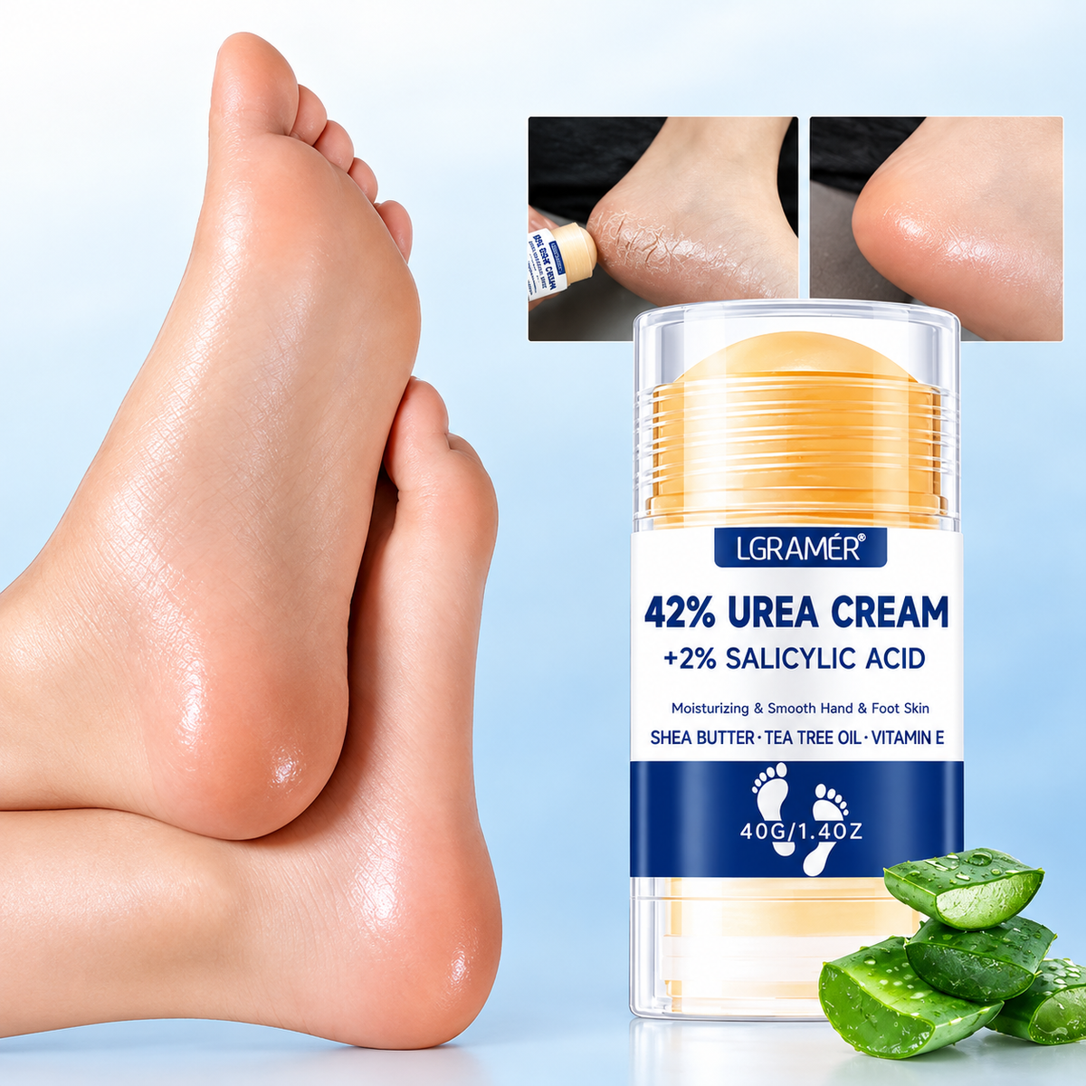 ⏳ Zeitlich begrenztes Angebot ✨ Urea Feuchtigkeitscreme – Intensive Feuchtigkeit für weichere, gepflegte Füße 💧
